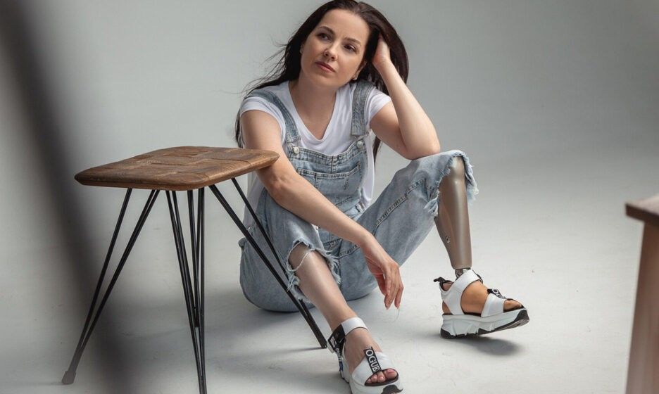 Девушка с протезом ноги